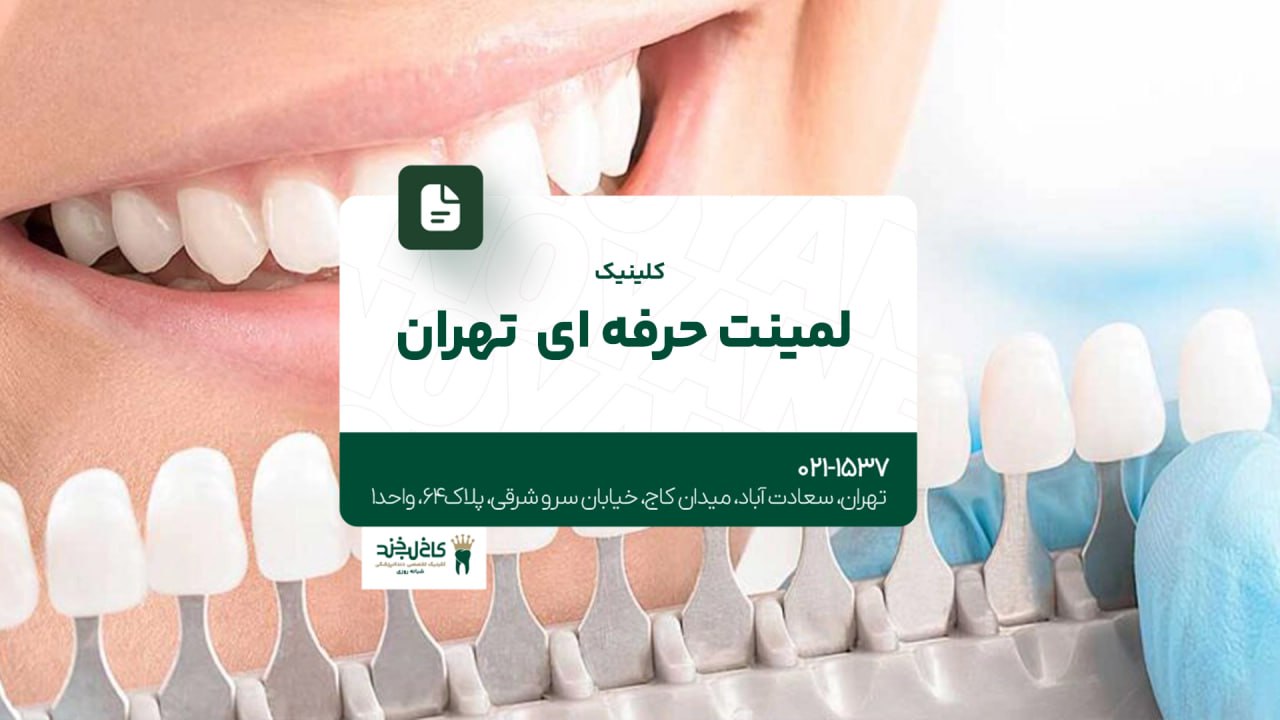 کلینیک لمینت حرفهای تهران