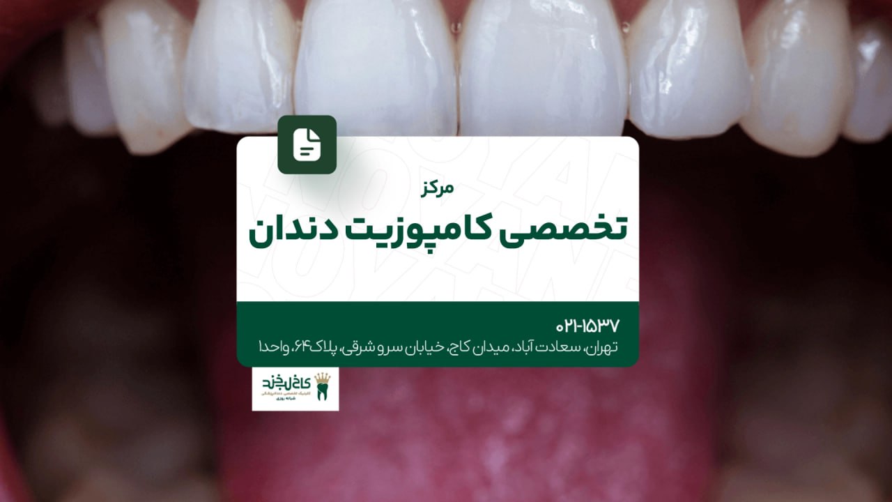 مرکز تخصصی کامپوزیت دندان