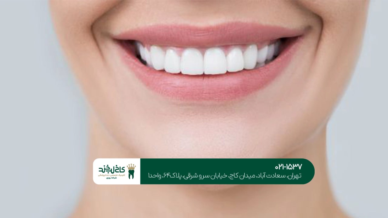 بهترین کلینیک زیبایی دندان