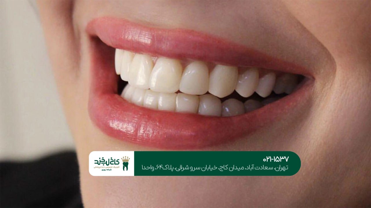 مرکز تخصصی زیبایی دندان