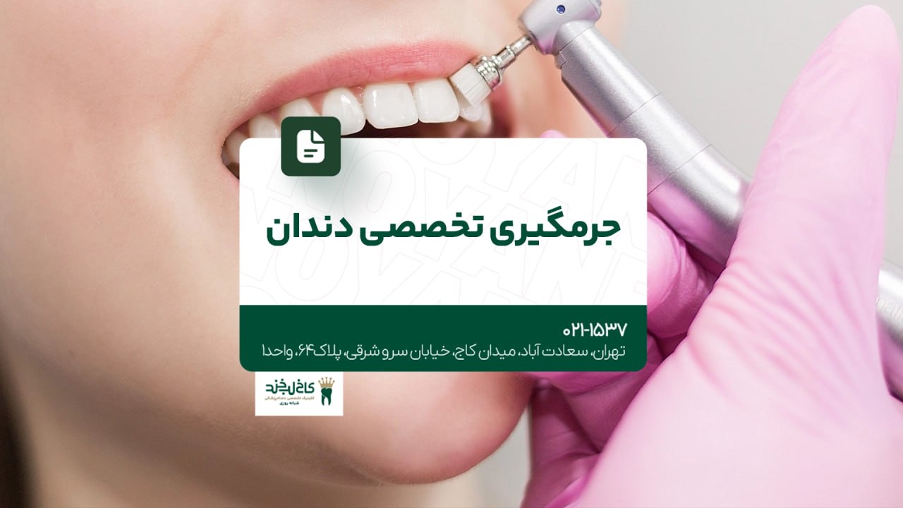 جرمگیری تخصصی دندان