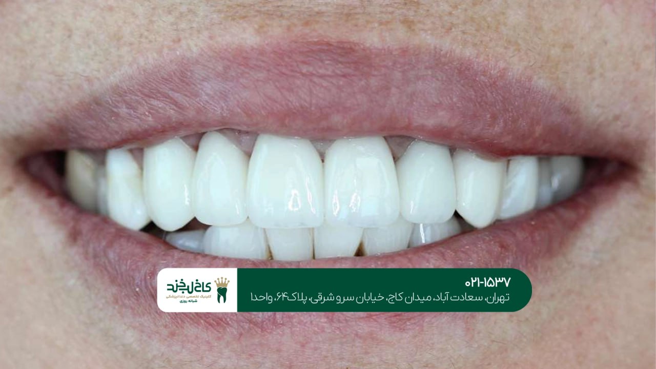 روتوش کامپوزیت