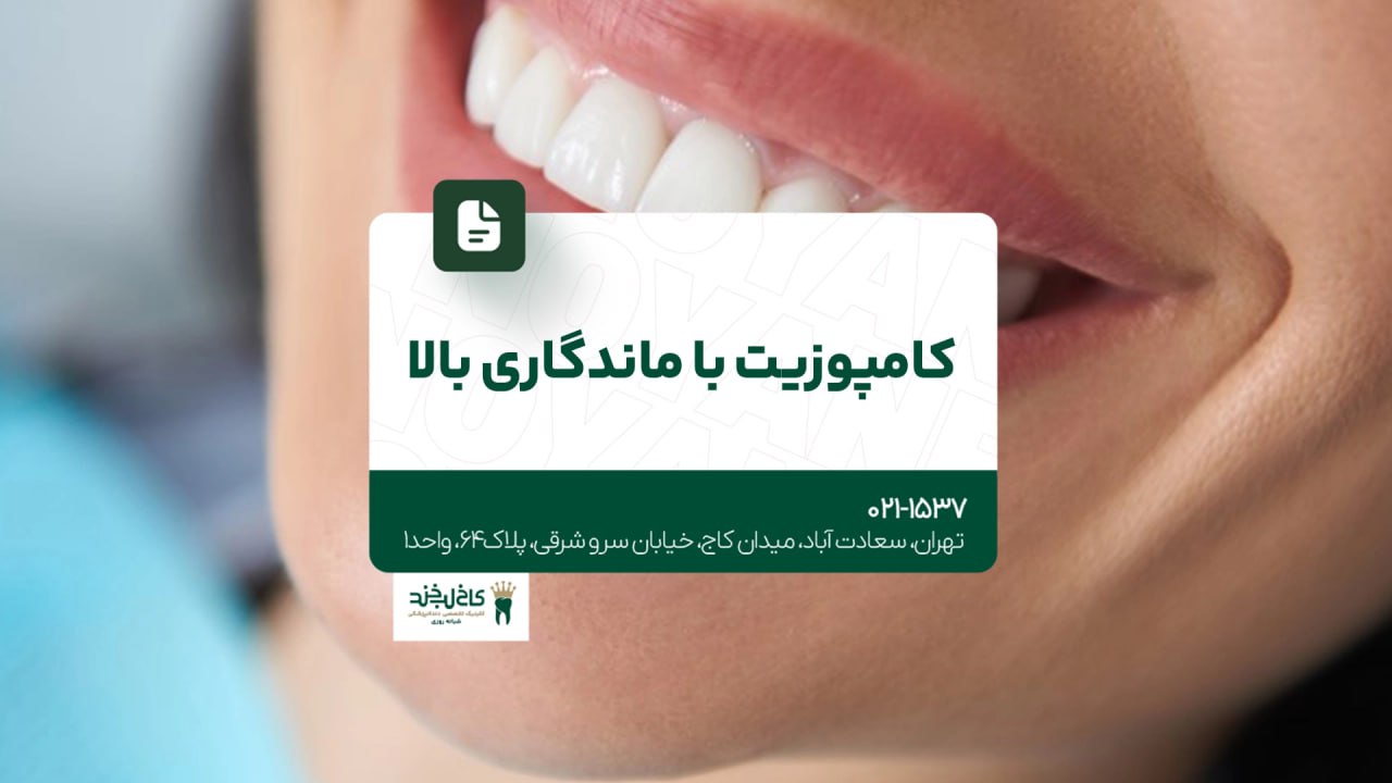 کامپوزیت با ماندگاری بالا