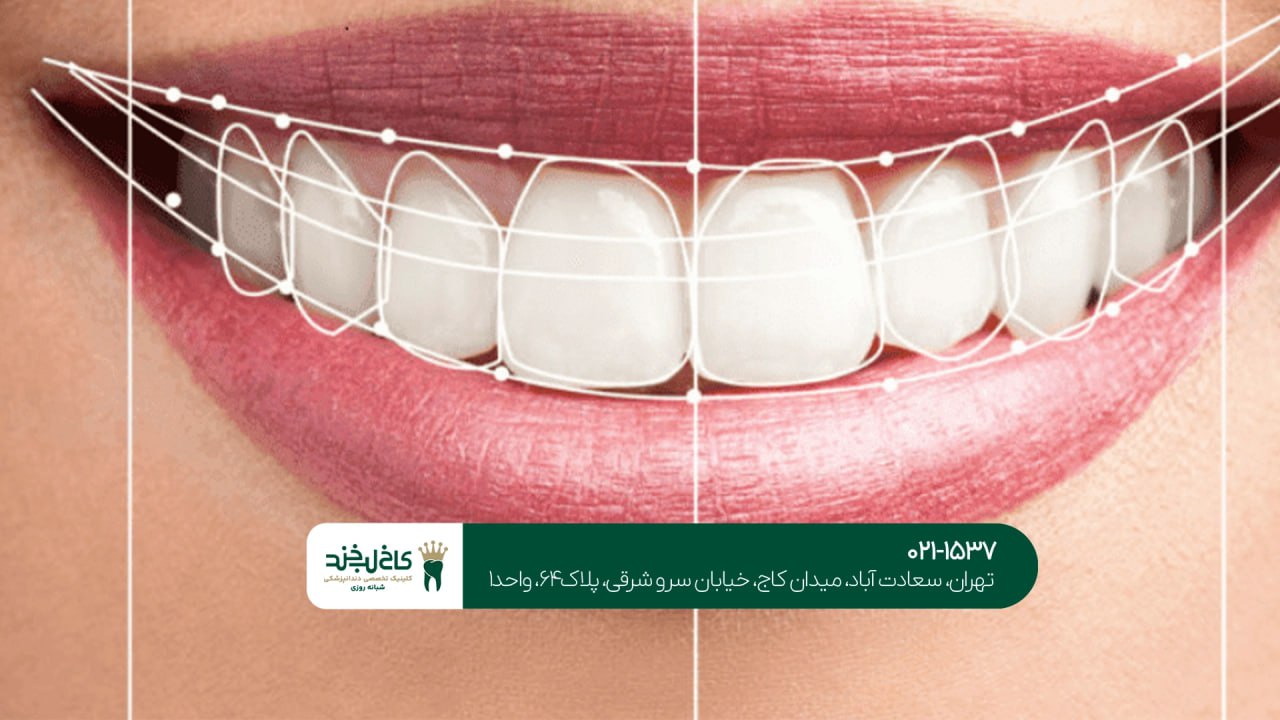بهترین کلینیک ترمیم لبخند