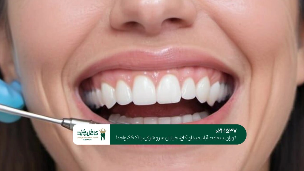 بهترین متخصص زیبایی دندان