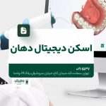 اسکن دیجیتال دهان