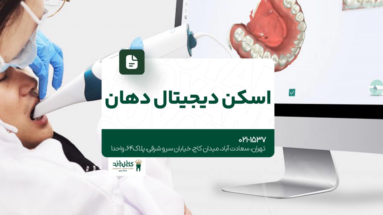 اسکن دیجیتال دهان