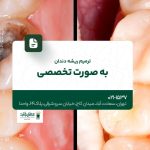 ترمیم ریشه دندان به صورت تخصصی