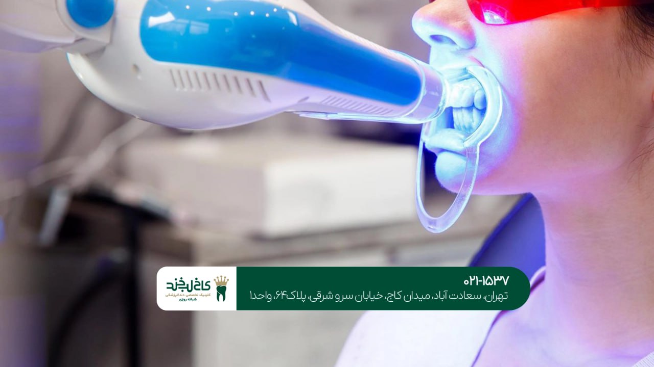 بلیچینگ در کلینیک دندانپزشکی