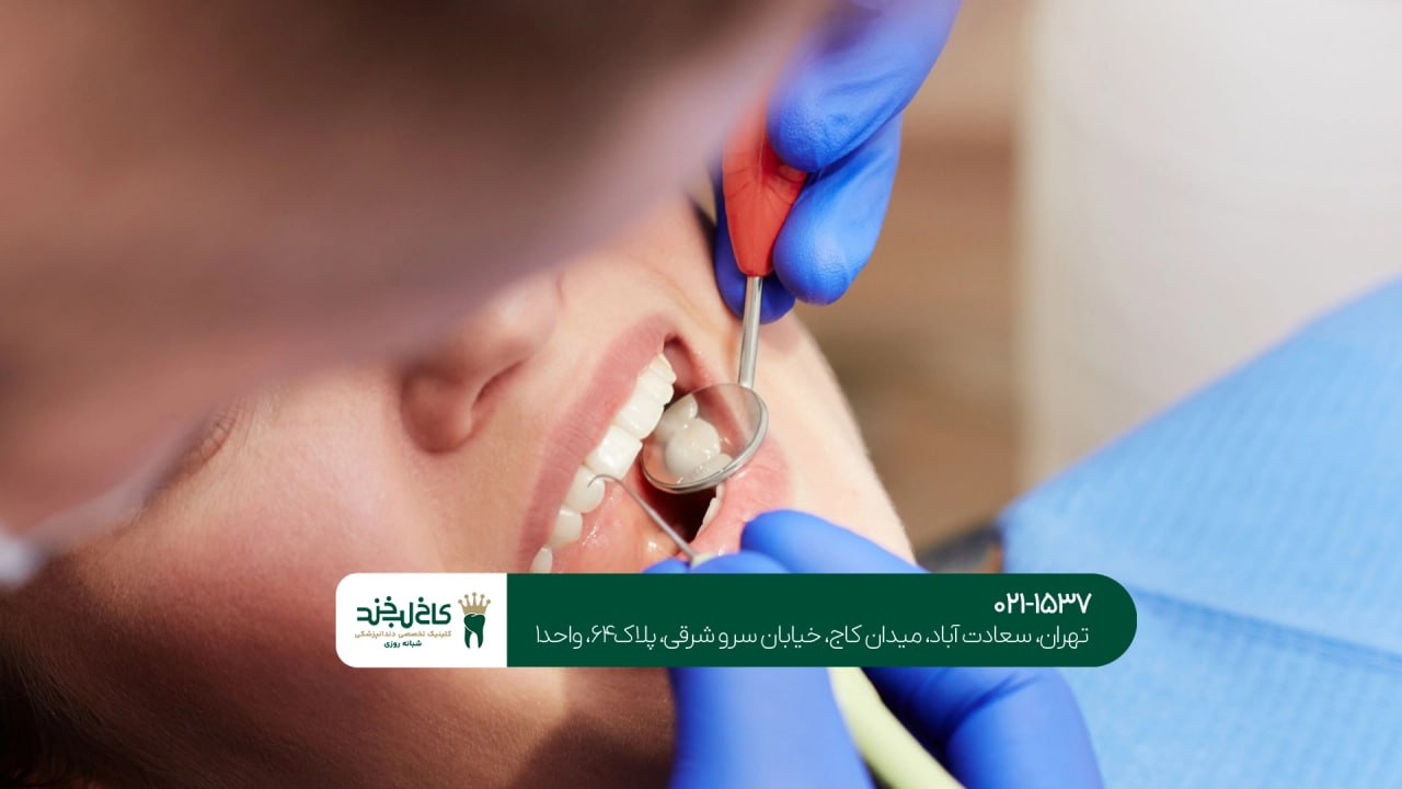 دندانپزشکی زیبایی تهران