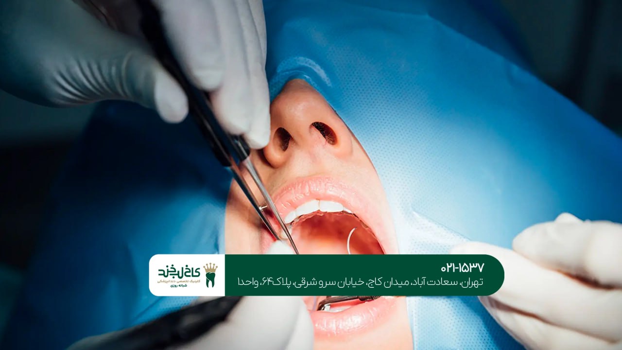 درمان فک و صورت