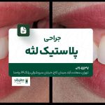 جراحی پلاستیک لثه