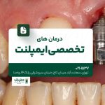 درمانهای تخصصی ایمپلنت