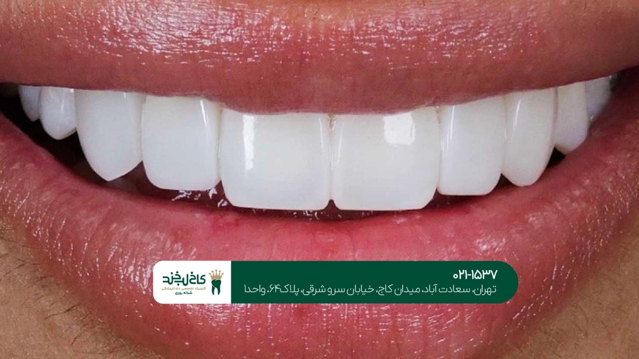 خدمات زیبایی دندان ایران