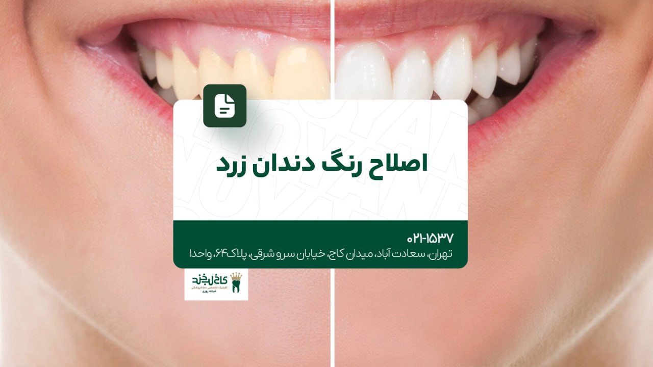 اصلاح رنگ دندان زرد