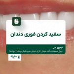 سفید کردن فوری دندان