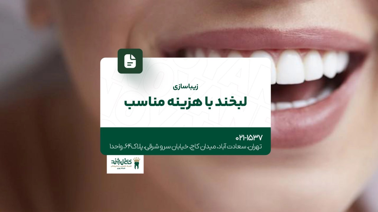 زیباسازی لبخند با هزینه مناسب