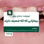 ایمپلنت دندان برای بیمارانی که لثه ضعیف دارند