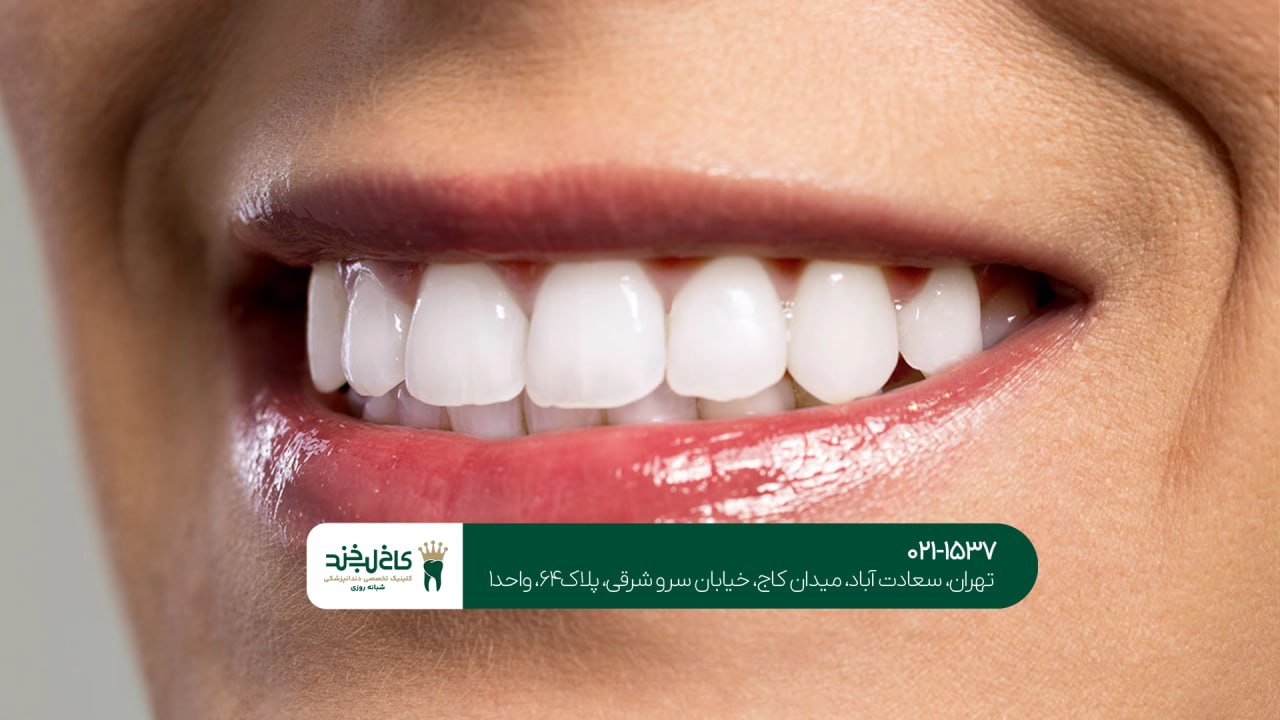 زیباسازی لبخند با هزینه مناسب