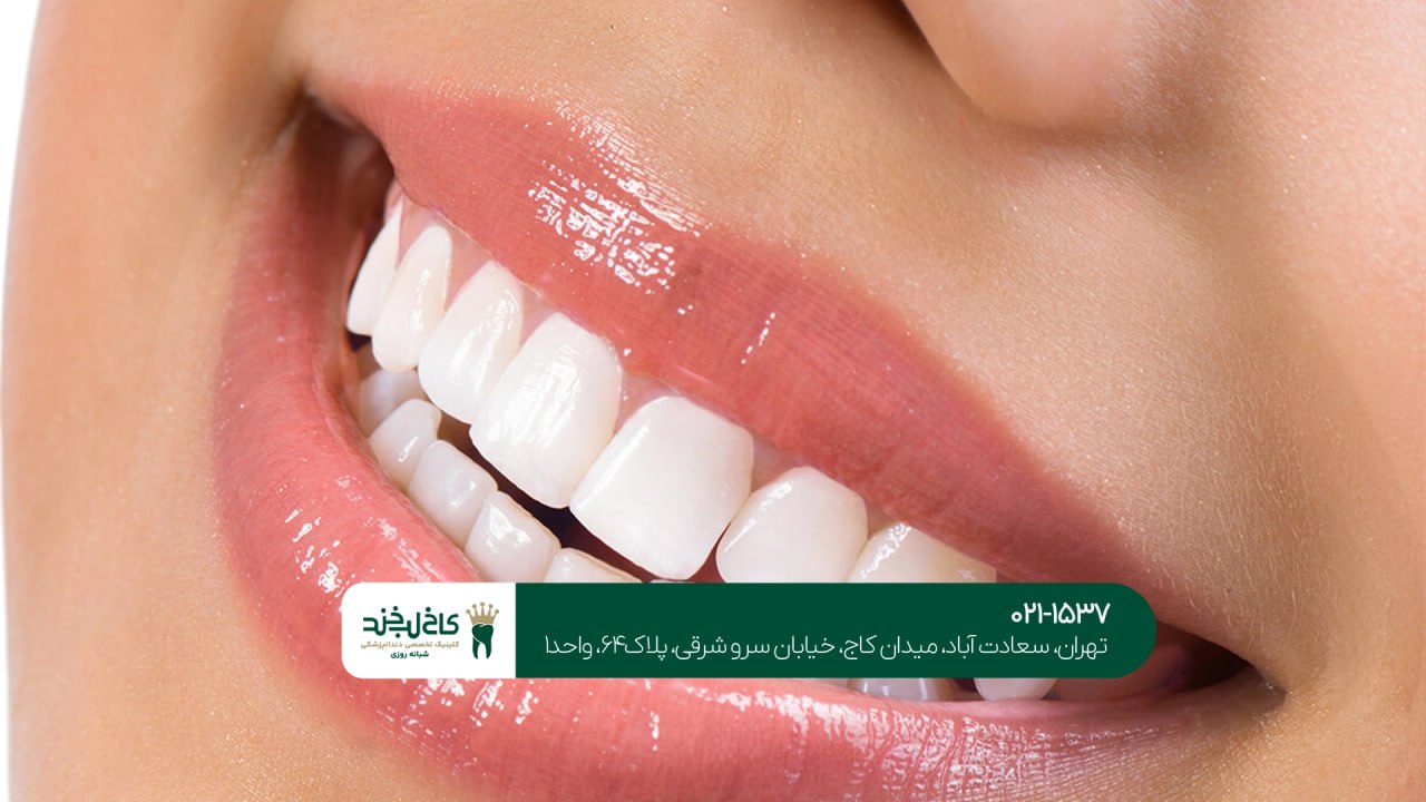 زیباسازی لبخند با هزینه مناسب