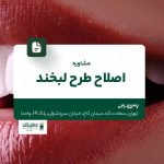 مشاوره اصلاح طرح لبخند