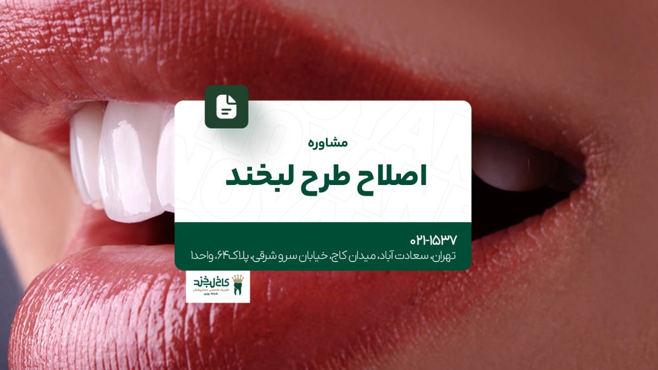 مشاوره اصلاح طرح لبخند