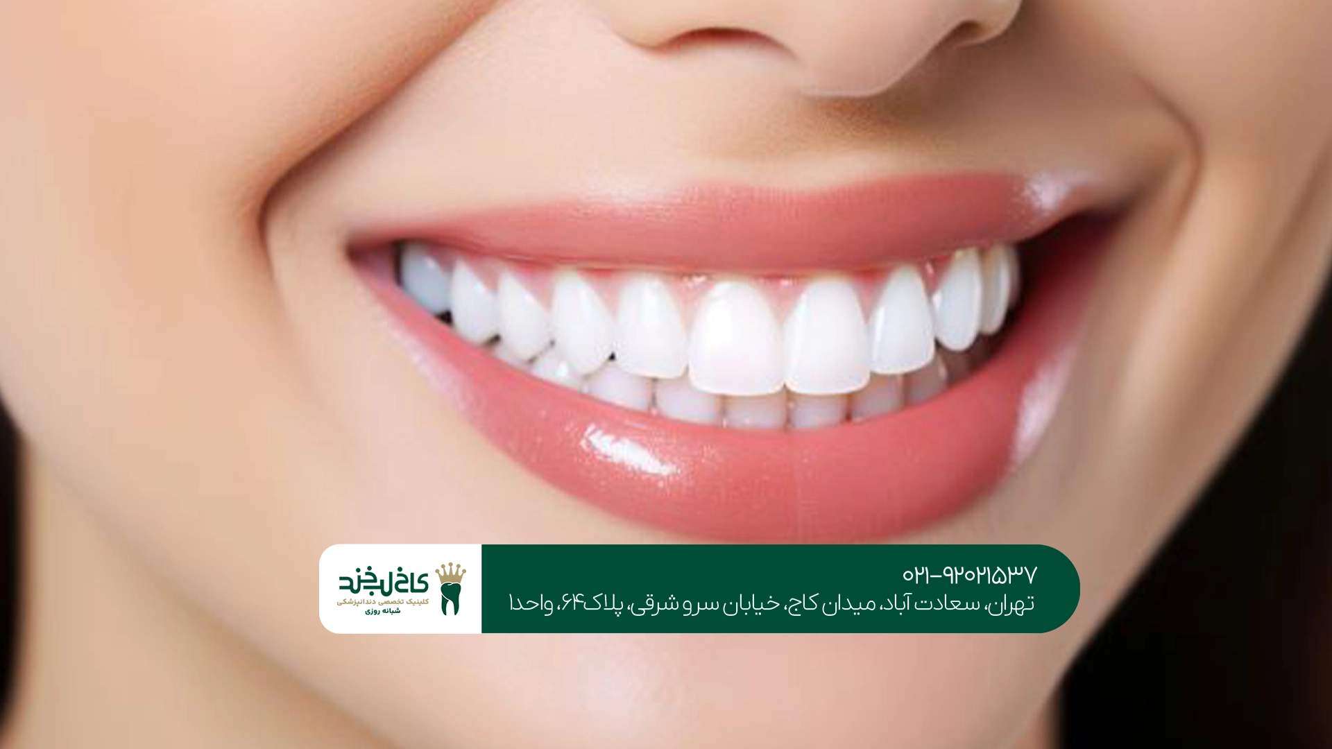 دندانپزشکی زیبایی دندانپزشکی زیبایی