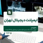 ایمپلنت دیجیتال تهران