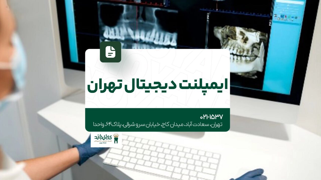 ایمپلنت دیجیتال تهران ایمپلنت دیجیتال تهران