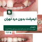 ایمپلنت بدون درد تهران