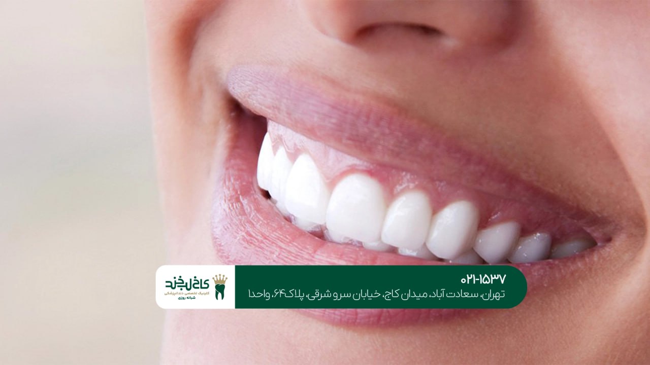 ویژگی های دندانپزشکی زیبایی در تهران ویژگی های دندانپزشکی زیبایی در تهران