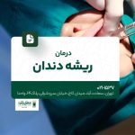 درمان ریشه دندان