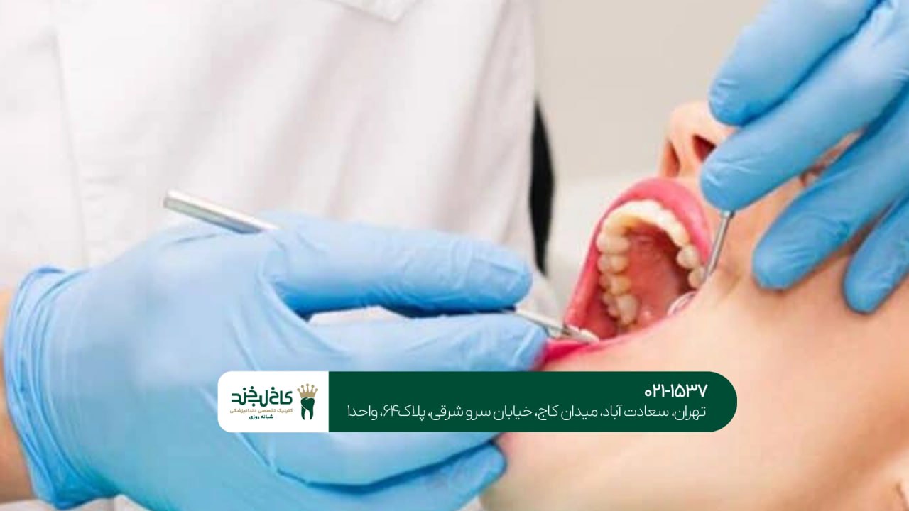 علائم درد ریشه دندان علائم درد ریشه دندان