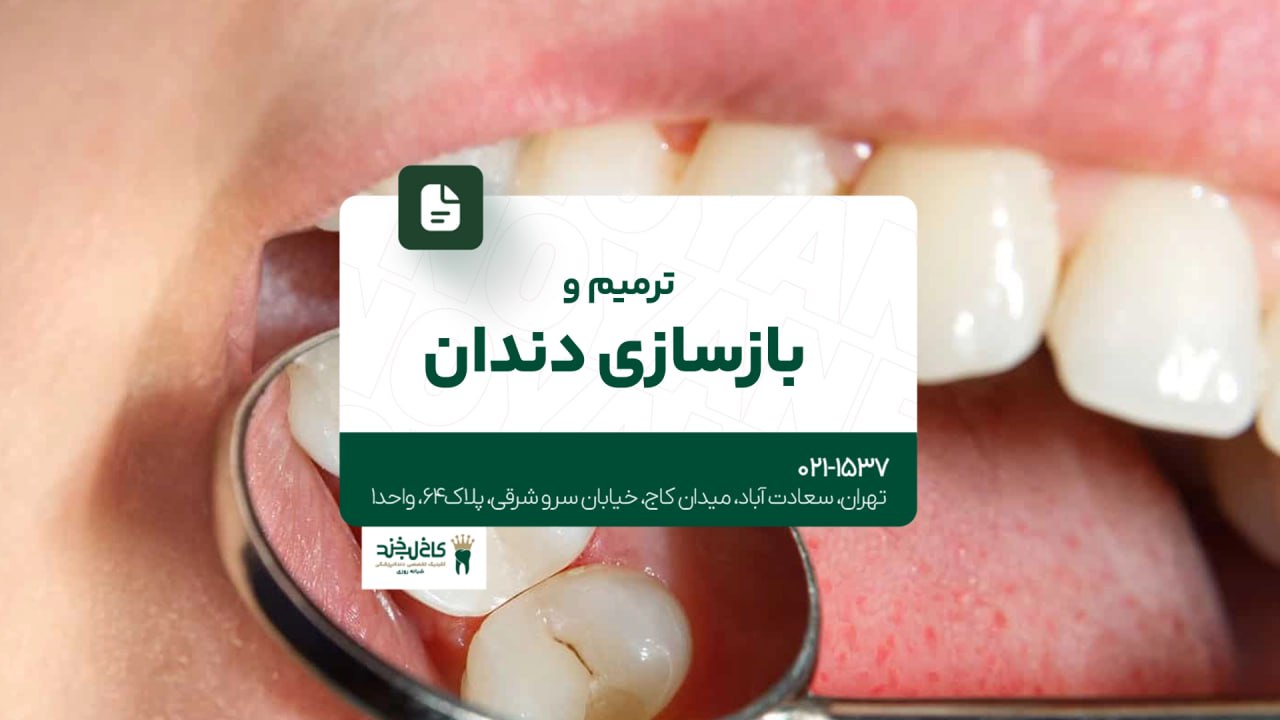 ترمیم و بازسازی دندان ترمیم و بازسازی دندان