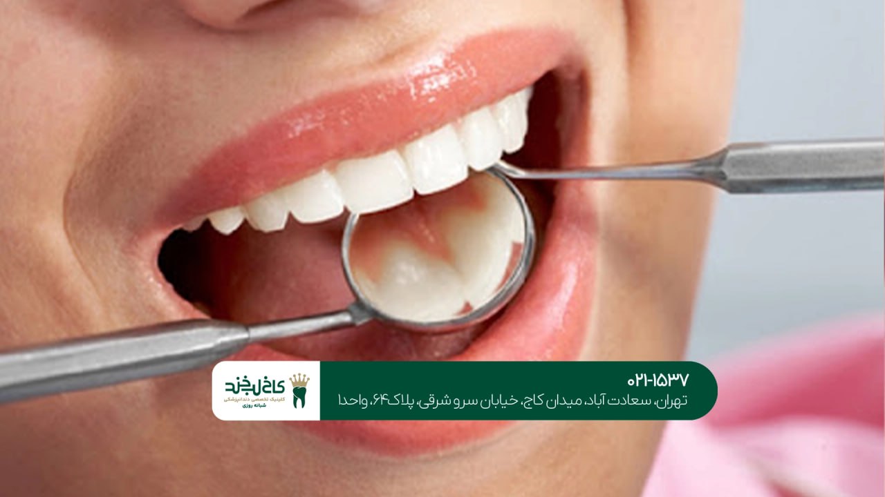 خدمات دندانپزشکی پیشرفته خدمات دندانپزشکی پیشرفته