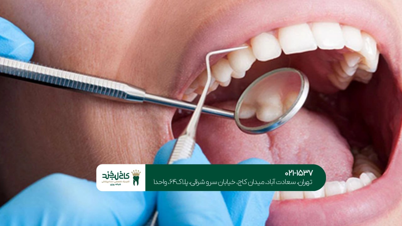 خدمات دندانی پیشرفته خدمات دندانی پیشرفته