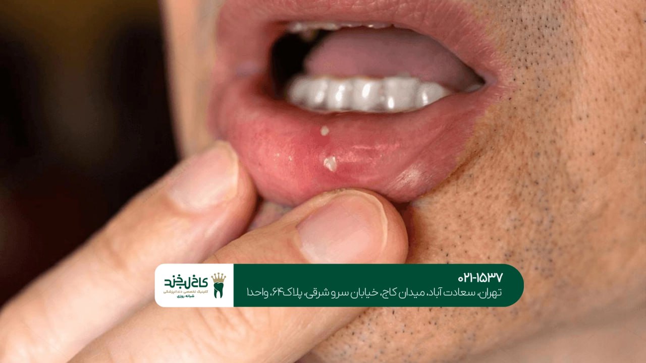 دندانپزشکی بدون درد دندانپزشکی بدون درد