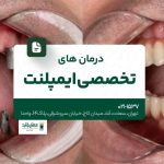 درمان های تخصصی ایمپلنت