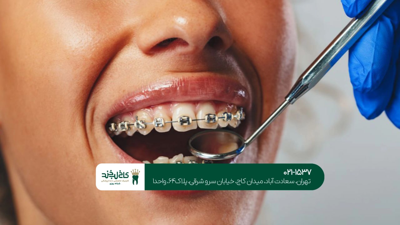 ارتودنسی ارتودنسی