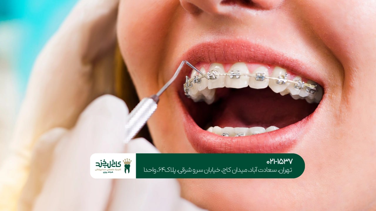 دندانپزشک ارتودنسی دندانپزشک ارتودنسی