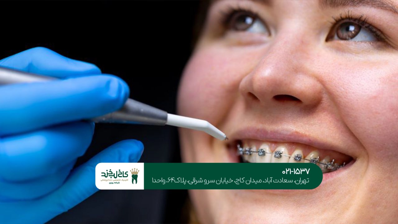 ارتودنسی دندان ارتودنسی دندان