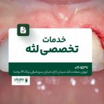 خدمات تخصصی لثه