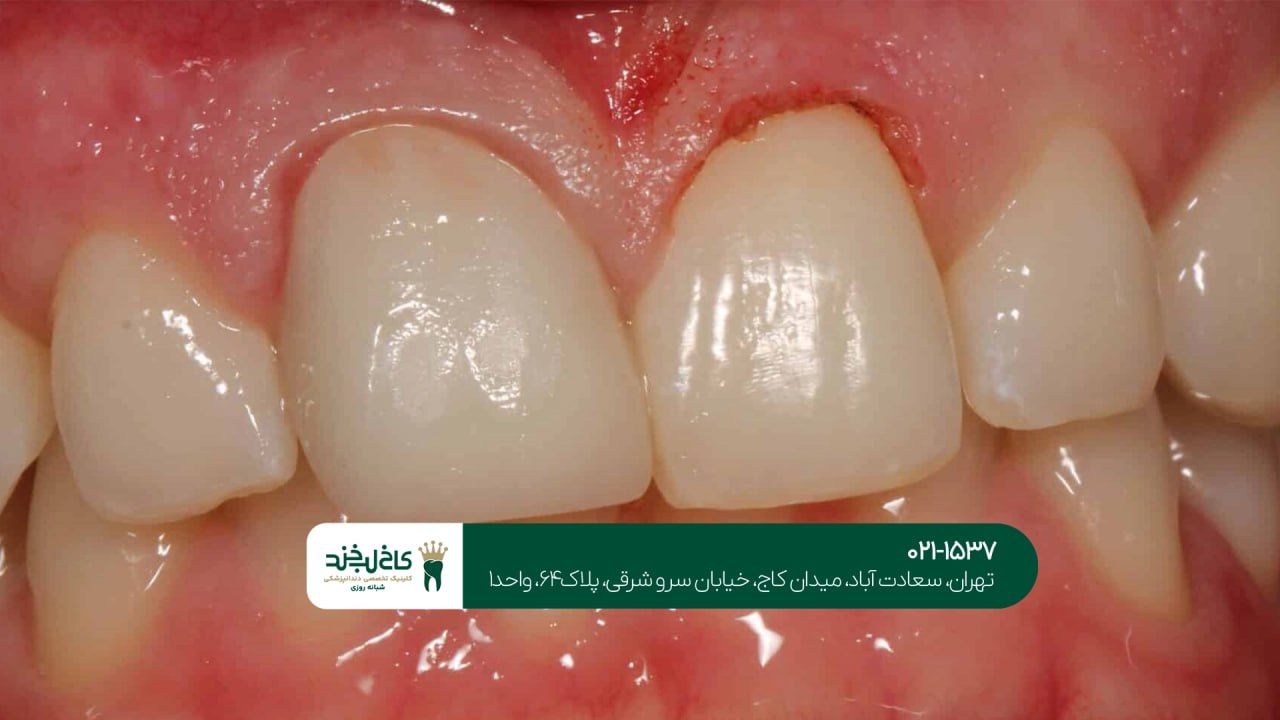 کلینیک تخصصی جراحی لثه کلینیک تخصصی جراحی لثه