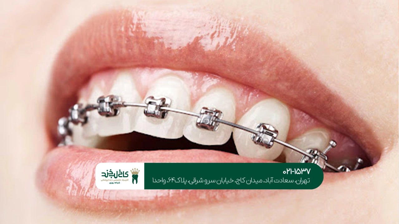 ارتودنسی دندان در تهران ارتودنسی دندان در تهران