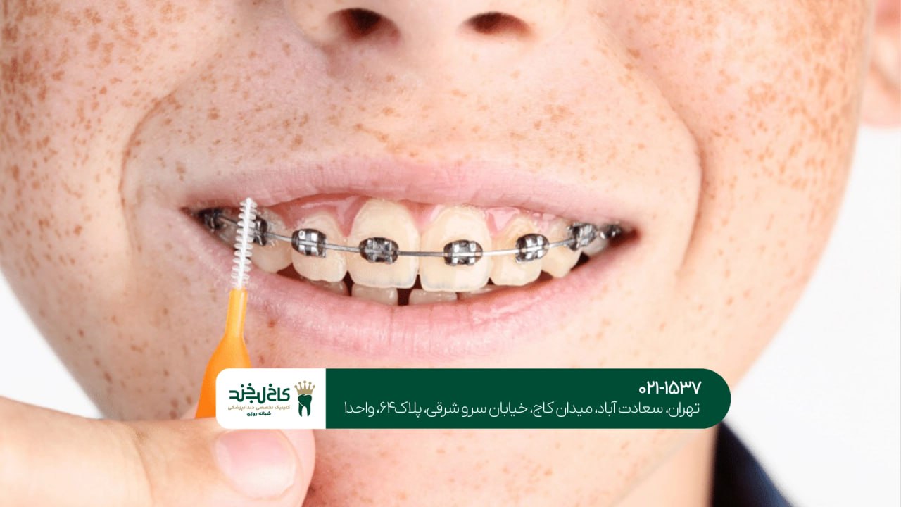 ارتودنسی دندان ارتودنسی دندان