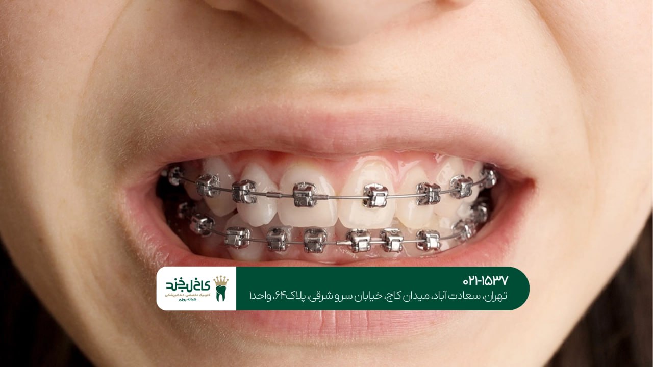 کلینیک ارتودنسی در تهران کلینیک ارتودنسی در تهران