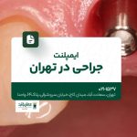 ایمپلنت جراحی در تهران