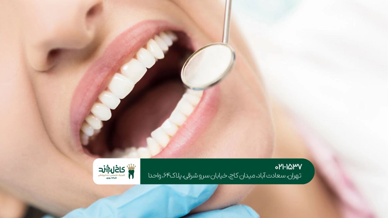 دندانپزشکی زیبایی دندانپزشکی زیبایی