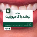 طراحی لبخند با کامپوزیت