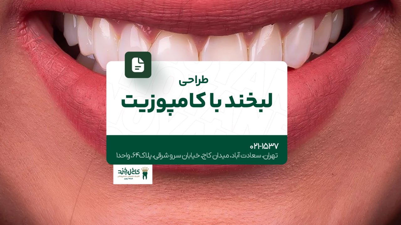 طراحی لبخند با کامپوزیت